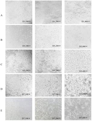 Anti-cancer immune effect of human colorectal cancer neoantigen peptide based on MHC class I molecular affinity screening